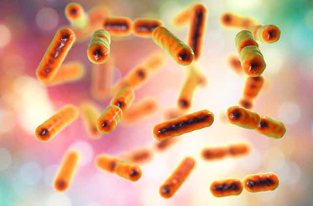 Researchers identify three intestinal bacteria found in dementia with Lewy bodies