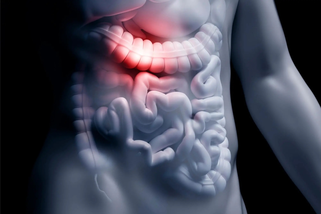 Long COVID Means Increased Risk of Long-Term Gastrointestinal Problems
