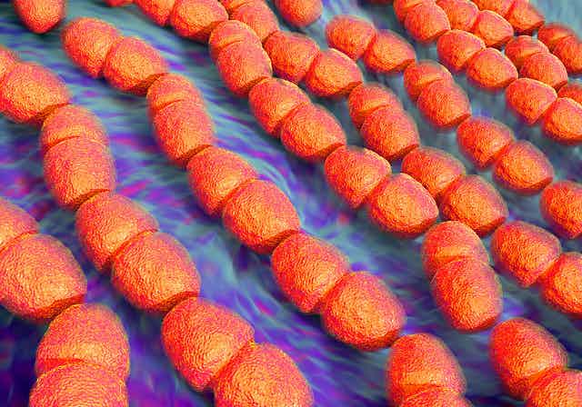 Gut microbiome changes linked to precancerous colon polyps